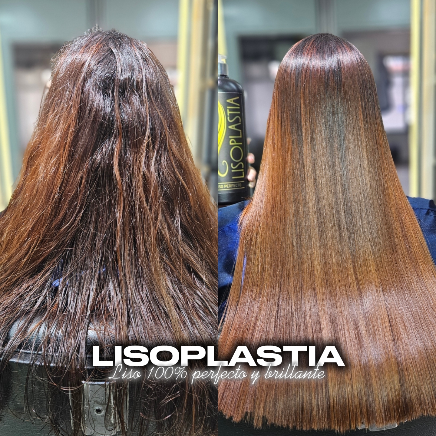 Antes y Después - Lisoplastia